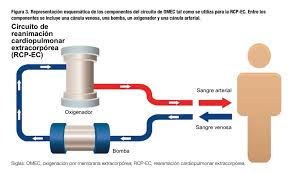 RCP extracorpórea